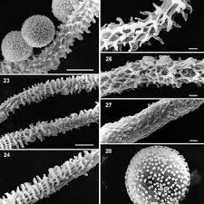 Attēlu rezultāti vaicājumam “Arcyria cinerea spores”