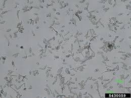 Attēlu rezultāti vaicājumam “Fuligo laevis spores”