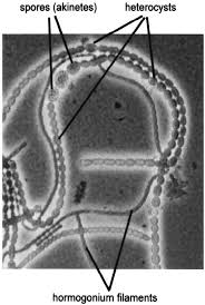 Attēlu rezultāti vaicājumam “Nostoc pruniforme cells”