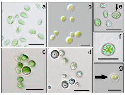 Attēlu rezultāti vaicājumam “Chaenotheca chlorella”