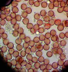 Attēlu rezultāti vaicājumam “Lamproderma debile”