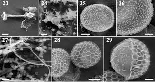 Attēlu rezultāti vaicājumam “Cribraria ferruginea spores”