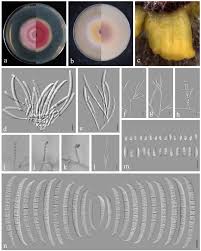 Attēlu rezultāti vaicājumam “Heterotrichia insignis (syn. Arcyria insignis) macro”