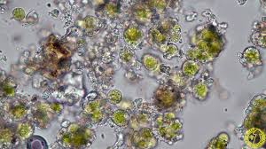 Attēlu rezultāti vaicājumam “Chaenotheca brunneola”