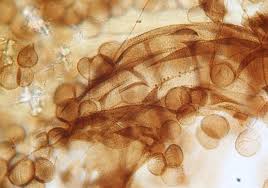 Attēlu rezultāti vaicājumam “Didymium serpula”