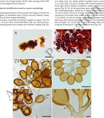 Attēlu rezultāti vaicājumam “Enteridium variabile spores”