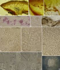 Attēlu rezultāti vaicājumam “Ombrophila violacea spores”