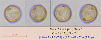 Attēlu rezultāti vaicājumam “Stemonitopsis typhina spores”