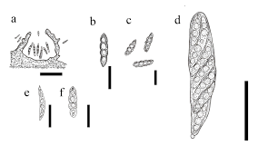 Attēlu rezultāti vaicājumam “Amaurochaete fusiformis spores”