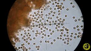 Attēlu rezultāti vaicājumam “Lycogala conicum macro”