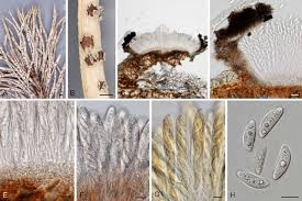 Attēlu rezultāti vaicājumam “Ombrophila violacea spores”