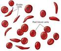 Blood Disorders