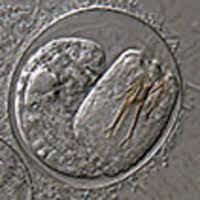 Attēlu rezultāti vaicājumam “Comatricha elegans var. microspora”