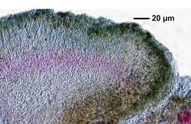 Attēlu rezultāti vaicājumam “Trapeliopsis flexuosa”