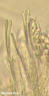 Attēlu rezultāti vaicājumam “Bisporella citrina”