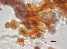 Attēlu rezultāti vaicājumam “Gloeocapsa rupestris”