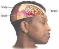 ... of New Mexico Health Sciences Center neurologist shows that brain injury ... - head-injury-554000