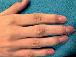 Image result for lunula nail