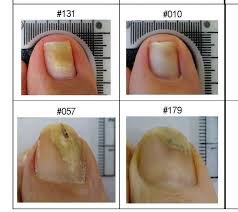 Image result for lunula nail