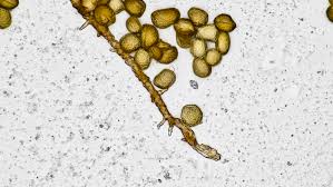 Attēlu rezultāti vaicājumam “Gulielmina vermicularis”