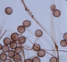 Attēlu rezultāti vaicājumam “Diderma globosum”