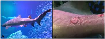 Attēlu rezultāti vaicājumam “Diderma tigrinum macro”