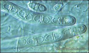 Attēlu rezultāti vaicājumam “Acrocordia gemmata”