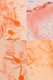 Attēlu rezultāti vaicājumam “Exidia cartilaginea”