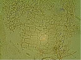 Attēlu rezultāti vaicājumam “Hyalorbilia inflatula”