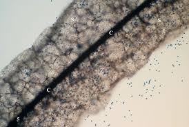 Attēlu rezultāti vaicājumam “myxomicetes”