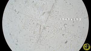 Attēlu rezultāti vaicājumam “Ceriporia viridans”