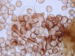 Attēlu rezultāti vaicājumam “Didymium serpula”