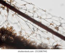 Attēlu rezultāti vaicājumam “Stemonitis flavogenita spores”