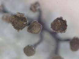 Attēlu rezultāti vaicājumam “Chaenotheca chrysocephala”