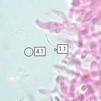 Attēlu rezultāti vaicājumam “Phlebia tremellosa”
