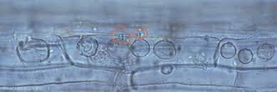 Attēlu rezultāti vaicājumam “Enteridium olivaceum spores”