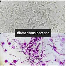 Attēlu rezultāti vaicājumam “Sanionia uncinata  sporophyte”