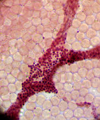 Attēlu rezultāti vaicājumam “Cribraria oregana spores”