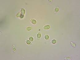 Attēlu rezultāti vaicājumam “Didymium clavus spores”