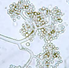 Attēlu rezultāti vaicājumam “Trichia botrytis var. cerifera spores”