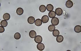 Attēlu rezultāti vaicājumam “Physarum braunianum spores”