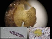 Attēlu rezultāti vaicājumam “Ascobolus furfuraceus”