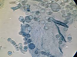 Attēlu rezultāti vaicājumam “Heterotrichia obvelata (syn. Arcyria obvelata) spores”