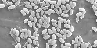 Attēlu rezultāti vaicājumam “Heterotrichia oerstedii (syn. Arcyria oerstedii) spores”