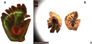 Image result for Reinhardtius hippoglossoides