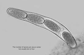 Attēlu rezultāti vaicājumam “Thelotrema lepadinum”