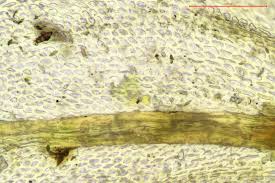 Attēlu rezultāti vaicājumam “Abietinella abietina var. hystricosa”