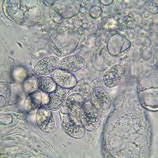 Attēlu rezultāti vaicājumam “Verrucaria hydrela”