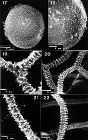 Attēlu rezultāti vaicājumam “Arcyria affinis spores”