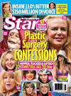 celebrity plastic surgery 2011